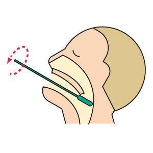 Der Antigen-Schnelltest